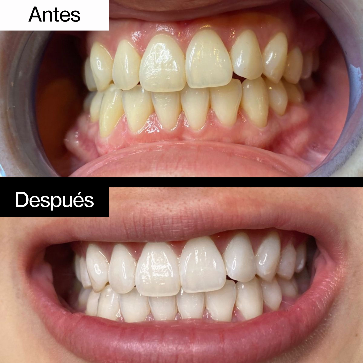 L'Oiré White Powder